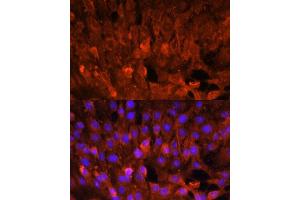 Immunofluorescence analysis of C6 cells using CISH antibody (ABIN7266663) at dilution of 1:100. (CISH 抗体  (AA 17-130))
