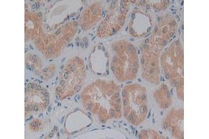 IHC-P analysis of Human Tissue, with DAB staining. (DBN1 抗体  (AA 3-134))