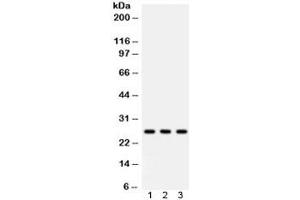 Western blot testing of 1) rat lung, 2) mouse lung, 3) A549 lysate with SFTPA1/2 antibody. (SFTPA1/ 2 抗体)