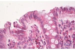 Image no. 2 for anti-Heparanase (HPSE) (AA 68-117) antibody (ABIN6749776) (HPSE 抗体  (AA 68-117))