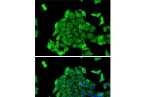 Immunofluorescence analysis of MCF7 cells using RPS14 Polyclonal Antibody (RPS14 抗体)