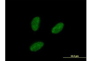 Immunofluorescence of purified MaxPab antibody to IRAK1BP1 on HeLa cell. (IRAK1BP1 抗体  (AA 1-260))