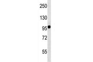 Integrin beta 7 antibody western blot analysis in WiDr lysate. (Integrin beta 7 抗体  (AA 737-765))