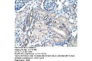 Rabbit Anti-MUC1 Antibody  Paraffin Embedded Tissue: Human Kidney Cellular Data: Epithelial cells of renal tubule Antibody Concentration: 4. (MUC1 抗体  (C-Term))