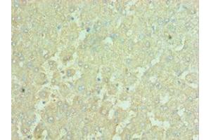 Immunohistochemistry of paraffin-embedded human liver tissue using ABIN7150150at dilution of 1:100 (APOBEC3C 抗体  (AA 1-190))