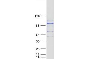 Western Blotting (WB) image for Interleukin 17 Receptor C (IL17RC) (Transcript Variant 1) protein (Myc-DYKDDDDK Tag) (ABIN2723367)