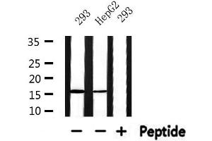 Western blot analysis of extracts from HepG2 and 293, using RPS19 Antibody. (RPS19 抗体  (Internal Region))