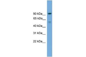 WB Suggested Anti-C16orf71 Antibody Titration: 0. (C16ORF71 抗体  (Middle Region))