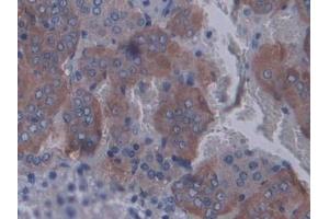 Detection of STAT2 in Rat Adrenal gland Tissue using Polyclonal Antibody to Signal Transducer And Activator Of Transcription 2 (STAT2)