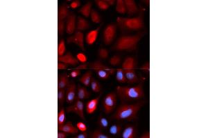 Immunofluorescence analysis of U20S cell using PDLIM5 antibody. (PDLIM5 抗体)