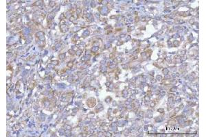 IHC analysis of Hamartin/TSC1 using anti-Hamartin/TSC1 antibody (ABIN7599499). (TSC1 抗体  (AA 1-618))