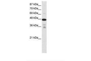 Image no. 2 for anti-Protein Arginine Methyltransferase 2 (PRMT2) (N-Term) antibody (ABIN203135) (PRMT2 抗体  (N-Term))