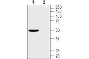 Western Blotting (WB) image for anti-Solute Carrier Family 2 (Facilitated Glucose Transporter), Member 2 (SLC2A2) (AA 496-508), (Intracellular) antibody (ABIN7043694)