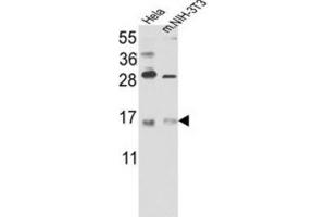 Western Blotting (WB) image for anti-RNA Binding Motif Protein 3 (RBM3) antibody (ABIN3003187) (RBM3 抗体)
