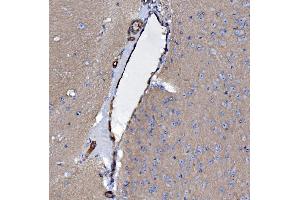 IHC analysis of EHD3 using anti-EHD3 antibody (ABIN7602777). (EHD3 抗体  (C-Term))