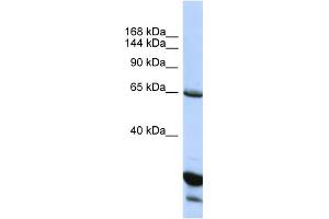 Host:  Rabbit  Target Name:  UNC5C  Sample Type:  HepG2 Whole Cell lysates  Antibody Dilution:  1. (Unc5c 抗体  (C-Term))
