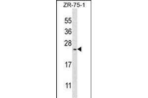 BarX1 Antibody (C-term) (ABIN391427 and ABIN2841420) western blot analysis in ZR-75-1 cell line lysates (35 μg/lane).