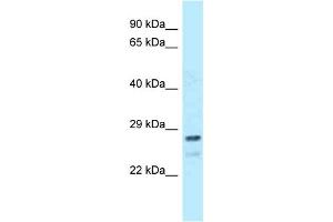 WB Suggested Anti-FKBP14 Antibody Titration: 1. (FKBP14 抗体  (Middle Region))