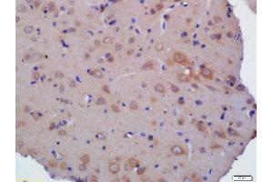 Formalin-fixed and paraffin embedded  labeled with Rabbit Anti- Polyclonal Antibody, Unconjugated at 1:200 followed by conjugation to the secondary antibody and DAB staining (Kelch-Like 24 抗体  (AA 1-100))