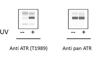 T47D cells were untreated or treated with UV. (ATR ELISA 试剂盒)