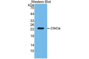 Western Blotting (WB) image for anti-Peptidoglycan Recognition Protein 1 (PGLYRP1) (AA 22-196) antibody (ABIN3204214) (PGLYRP1 抗体  (AA 22-196))