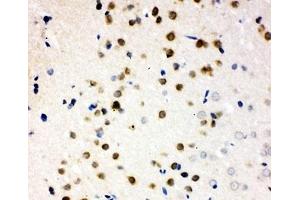 Immunohistochemistry (IHC) image for anti-Polo-Like Kinase 2 (PLK2) (C-Term) antibody (ABIN3032267)