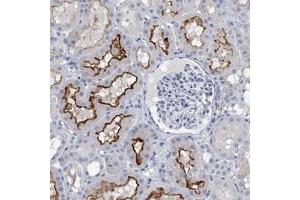 Immunohistochemical staining of human kidney with SLC34A3 polyclonal antibody  shows distinct membranous positivity in cells in tubules at 1:20-1:50 dilution. (SLC34A3 抗体)
