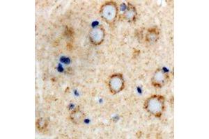 Immunohistochemical analysis of GLUR4 staining in human brain formalin fixed paraffin embedded tissue section. (GRIA4 抗体  (C-Term))