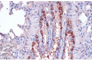 Immunohistochemistry of paraffin-embedded Rat lung using RPL22 Polyclonal Antibody at dilution of 1:100 (40x lens). (RPL22 抗体)