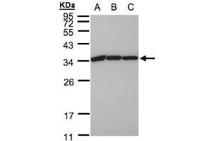 WB Image Sample(30 ug whole cell lysate) A:A431, B:H1299 C:HeLa S3, 12% SDS PAGE antibody diluted at 1:1000 (EEF1B2 抗体)