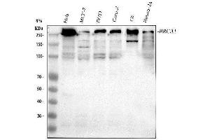 Western blot analysis of BRCA1 using anti-BRCA1 antibody (ABIN5518742). (BRCA1 抗体  (AA 1681-1781))