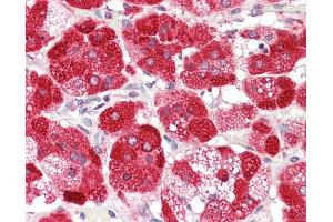 Immunohistochemistry (IHC) image for anti-Cytochrome P450, Family 21, Subfamily A, Polypeptide 2 (CYP21A2) (AA 314-363) antibody (ABIN6753003)