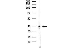 anti-Acetyl-CoA Acyltransferase 2 (ACAA2) (Internal Region) antibody