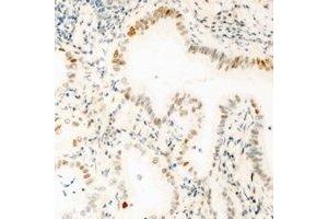 Immunohistochemical analysis of GABPB1 staining in mouse kidney formalin fixed paraffin embedded tissue section. (GABPB1 抗体)