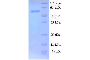 SDS-PAGE (SDS) image for Cystathionine-beta-Synthase (CBS) (AA 1-507), (full length) protein (His tag) (ABIN5713320)