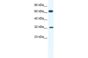 KCNN1 antibody used at 1. (KCNN1 抗体  (C-Term))