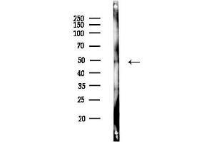 Western blot analysis of lysates from HUVEC cells(heat-shock,42 min treatment), using Casein Kinase Igamma1 Antibody at 1/1000 dilution.