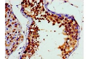 Immunohistochemistry (IHC) image for anti-Valosin Containing Protein (VCP) (AA 704-806) antibody (ABIN7172893)