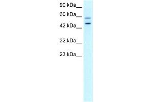 WB Suggested Anti-DKFZP761C169 Antibody Titration:  0. (GC-Rich Promoter Binding Protein 1 (GPBP1) (N-Term) 抗体)