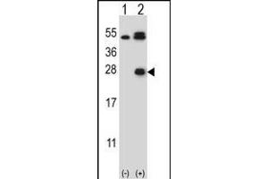 Western blot analysis of KLK6 (arrow) using rabbit polyclonal KLK6 Antibody  (ABIN652196 and ABIN2840742). (Kallikrein 6 抗体  (AA 126-156))