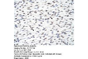 Rabbit Anti-HNRPLL Antibody  Paraffin Embedded Tissue: Human Heart Cellular Data: Myocardial cells Antibody Concentration: 4. (HNRPLL 抗体  (N-Term))