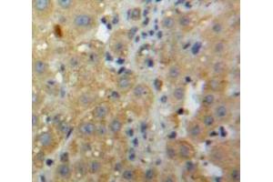 Used in DAB staining on fromalin fixed paraffin-embedded Liver tissue (CXCL2 抗体  (AA 28-100))