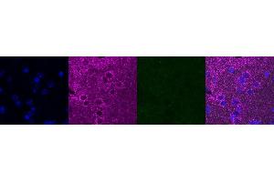 Immunohistochemistry (IHC) image for anti-ATP Synthase, H+ Transporting, Mitochondrial F1 Complex, alpha Subunit 1, Cardiac Muscle (ATP5A1) antibody (ABIN7456339)