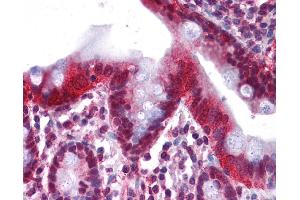 Immunohistochemistry (IHC) image for anti-Hepatocyte Nuclear Factor 4, alpha (HNF4A) (Middle Region) antibody (ABIN2779763) (HNF4A 抗体  (Middle Region))