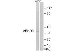Western blot analysis of extracts from MCF-7 cells, using ABHD9 antibody. (ABHD9 抗体)