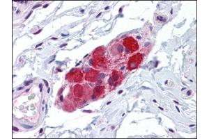 Immunohistochemistry (Paraffin-embedded Sections) (IHC (p)) image for anti-Transient Receptor Potential Cation Channel, Subfamily V, Member 2 (TRPV2) (Ser157) antibody (ABIN615540)