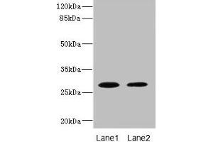 Western blot All lanes: TPK1 antibody at 0. (TPK1 抗体  (AA 1-243))