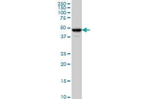 C17orf75 monoclonal antibody (M02), clone 2D7 Western Blot analysis of C17orf75 expression in HeLa . (C17orf75 抗体  (AA 1-100))