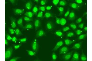 Immunofluorescence analysis of A549 cell using FANCD2 antibody. (FANCD2 抗体)