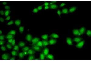 Immunofluorescence analysis of A-549 cells using GGH Polyclonal Antibody (GGH 抗体)
